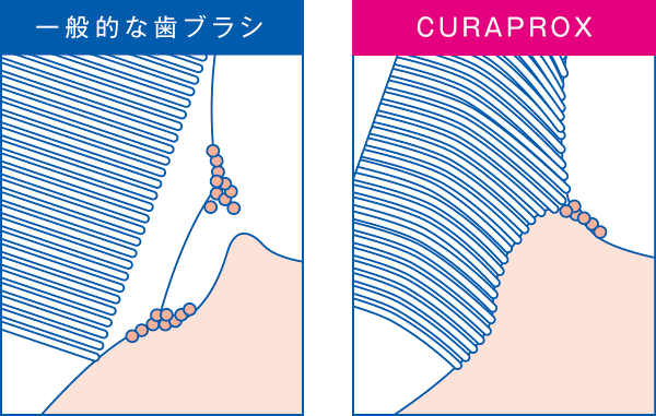 一般的な歯ブラシ | CURAPROX