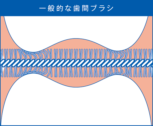 一般的な歯間ブラシ